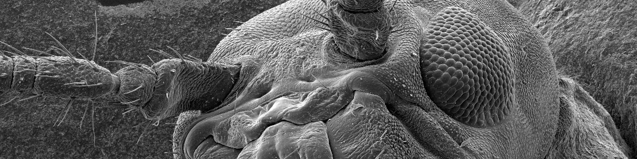 Scanning electron microscopy image of an insect head showing the surface structure