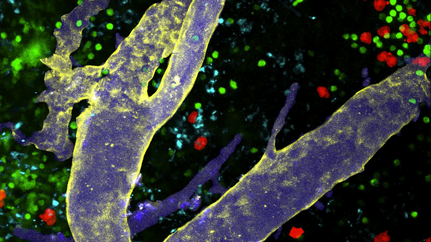 Light microscopy image of an inguinal lymph node labeled with multiple fluorescent markers. The multicolor labeling visualizes distinct cell types and structural regions within the lymph node