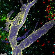 Light microscopy image of an inguinal lymph node labeled with multiple fluorescent markers. The multicolor labeling visualizes distinct cell types and structural regions within the lymph node