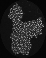 A monochrome fluorescence image of a yeast colony with highlighting the nuclear membrane