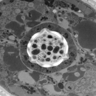 TEM cross section of the pharyngeal region of the nematode C. elegans, showing the ultrastructure of organs and cell types.