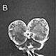 Fig.2 taken from Carvalho et al, 2010.