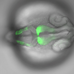Gokul Kesavan / Michael Brand - CTRD - Brain of a zebrafish embryo