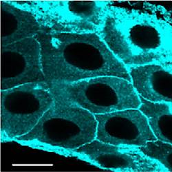 Fig.6 taken from Kupinski et al, 2013.