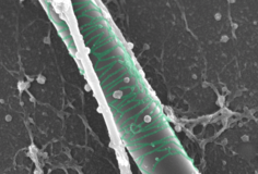 Thomas Kurt - EMF CRTD/BIOTEC - SEM image