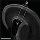 Fig.1 taken from Turrero-Garcia et al, 2016.