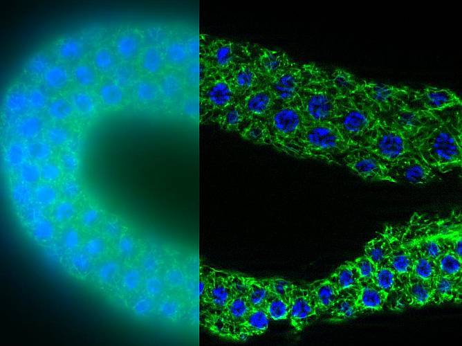 © Silke Tulok - MTZ, CFCI - C.Eleganse without and with ApoTome