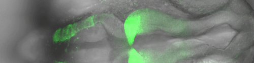 Transmitted Light and Fluorescence Microscopy image of the fluorescently labeled zebrafish embryo brain
