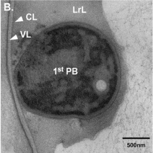 Fig.6 taken from Benenati et al, 2009.