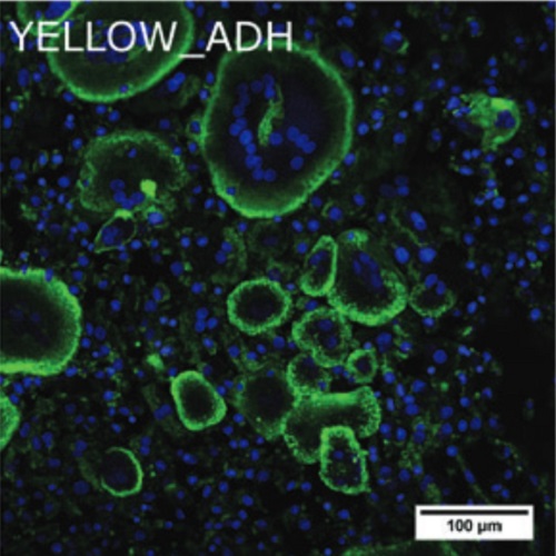 Fig.6 taken from Bernhardt et al, 2015.