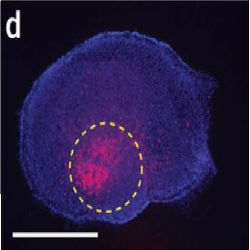 Fig.3 taken from Cambridge et al,2009.