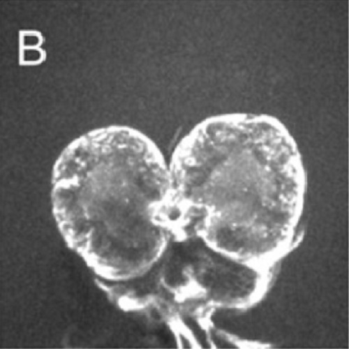 Fig.2 taken from Carvalho et al, 2010.