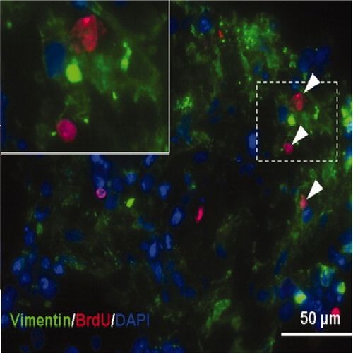 Fig.2 taken from Chung et al, 2009.