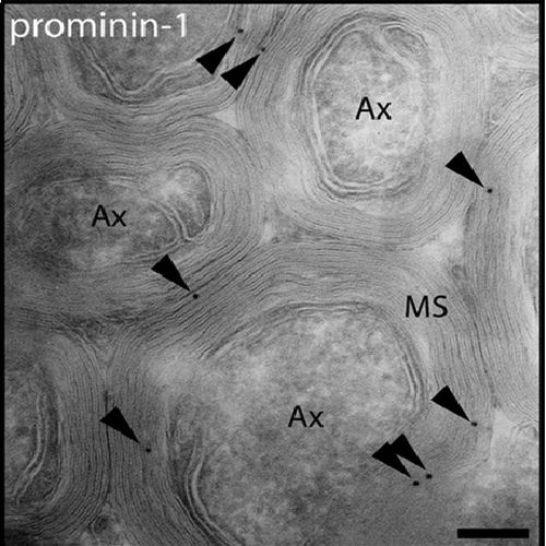 Fig.7 taken from Corbeil et al, 2009.