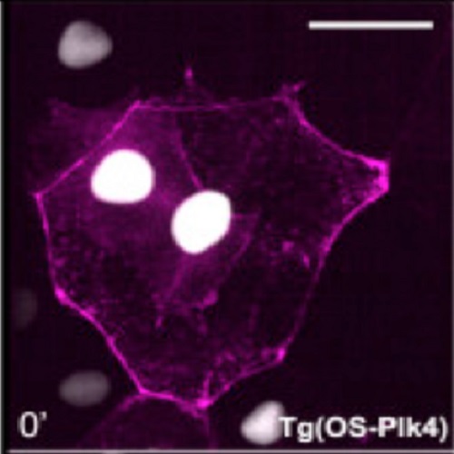 Fig.4 taken from Dzafic et al, 2015.