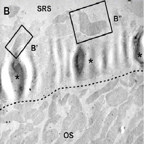 Fig.3 taken from Eberle et al, 2012.