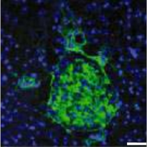 Fig.1 taken from Fuchs et al, 2014.