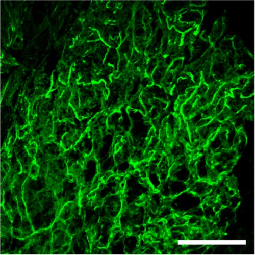 Fig.8 taken from Garcia-Martin et al, 2016.