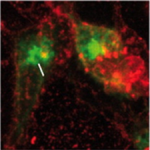 fig.3 taken from Garcia-Saez et al, 2011.