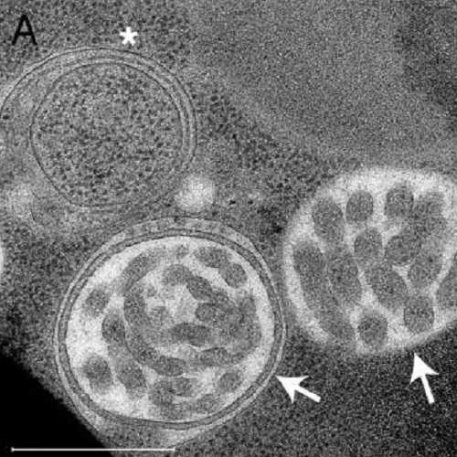 Fig.1 taken from Gloor et al, 2012.