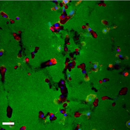 Fig.4 taken from Goetz et al, 2013.