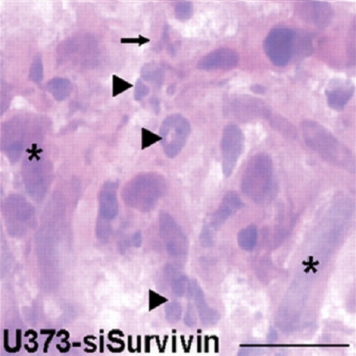 Fig.7 taken from Hendruschk et al, 2011.