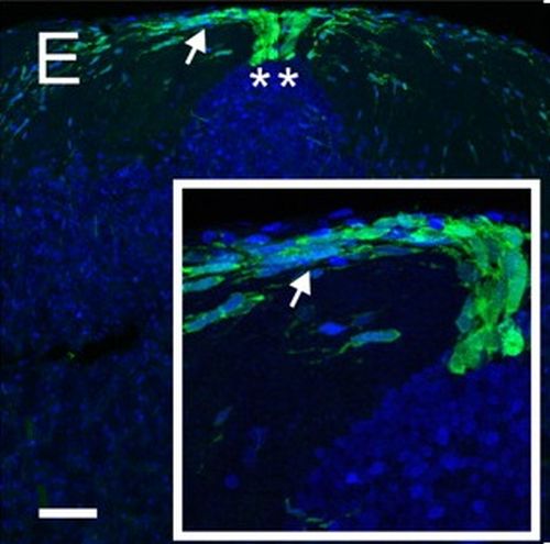 Fig.4 taken from Kaslin et al, 2009.