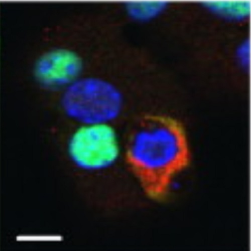 Fig.6 taken from Knoch et al, 2014.