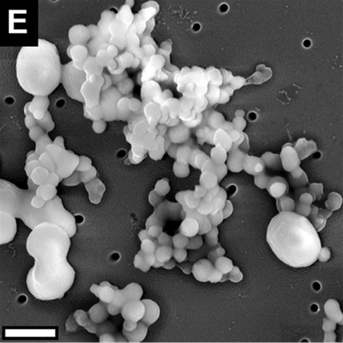 Fig.2 taken from Kotzsch et al, 2016.