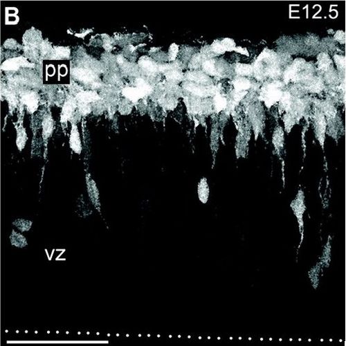 Fig.4 taken from Kowalczyk et al, 2009.