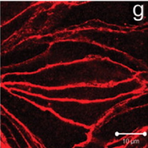 Fig.3 taken from Kronstein et al, 2012.