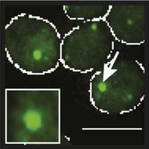 Fig.1 taken from Kroschwald et al, 2015.