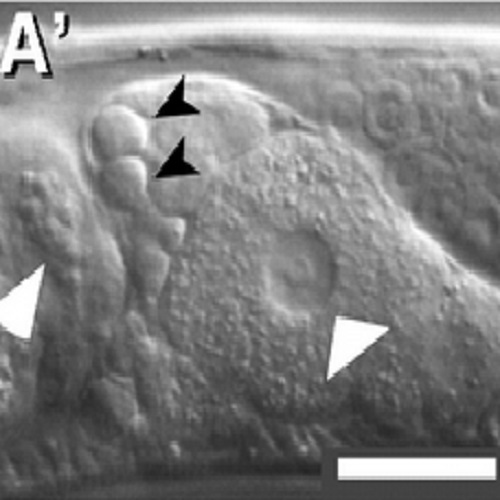 Fig.2 taken from Kupinski et al, 2010.