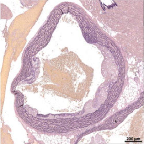 Fig.2 taken from Langbein et al, 2016.