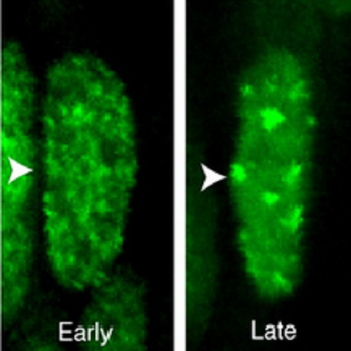 Fig.1 taken from Leung et al, 2011.