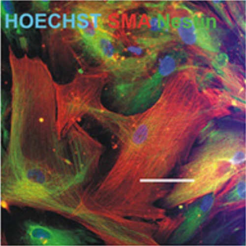 Fig.1 taken from Lojewski et al, 2015.