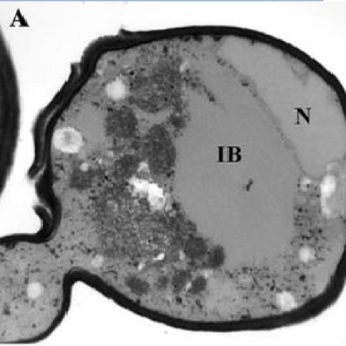 Fig.4 taken from Ma E et al, 2011.