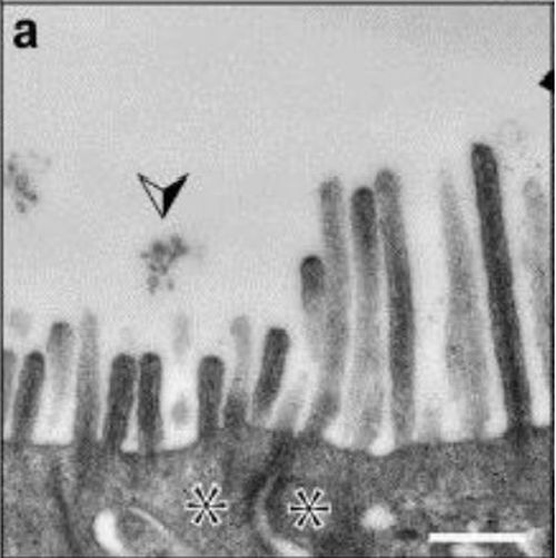 Fig.3 taken from Marzesco et al, 2009.