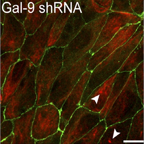 Fig.1 taken from Mishra et al, 2010.