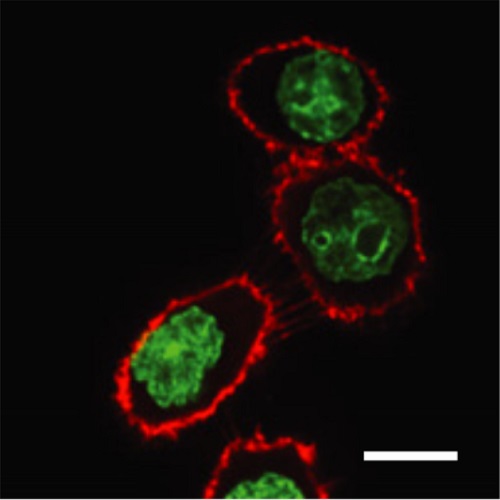 Fig.1 taken from Özlü et al, 2015.