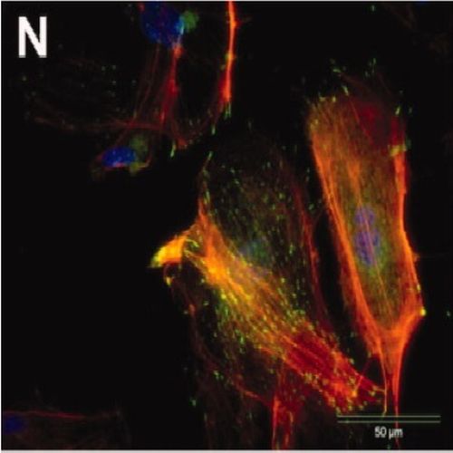 Fig.1 taken from Ozkucur et al, 2010.