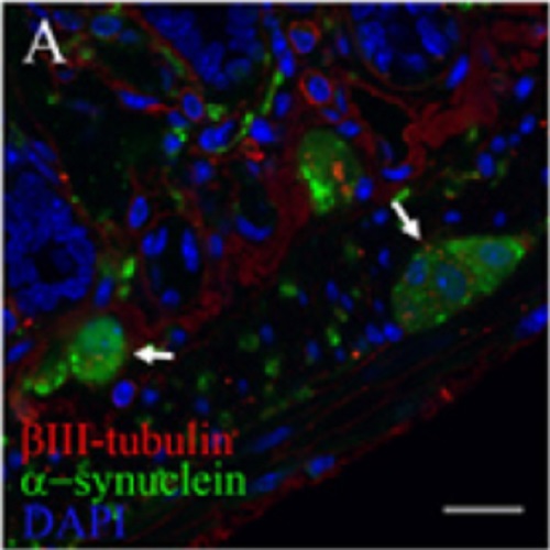 Fig.2 taken from Pan-Montojo et al, 2010.