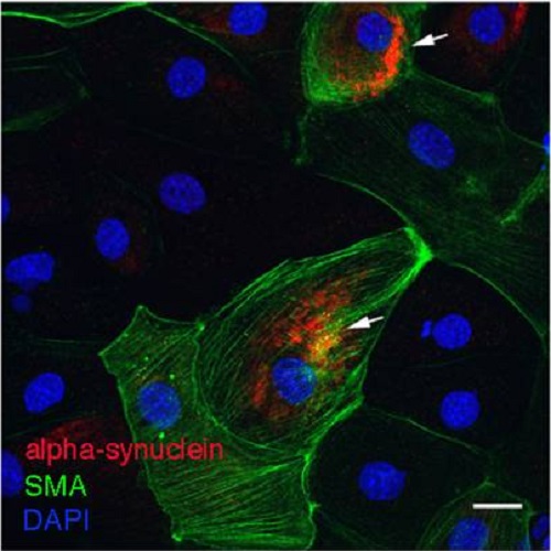 Fig.5 taken from Pan-Montojo et al, 2012.