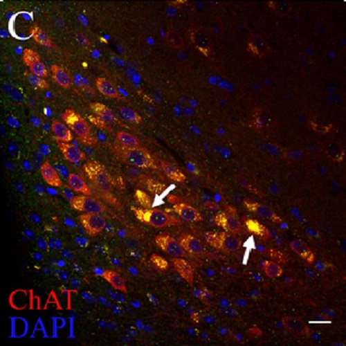 Fig.3 taken from Pan-Montojo et al, 2010.