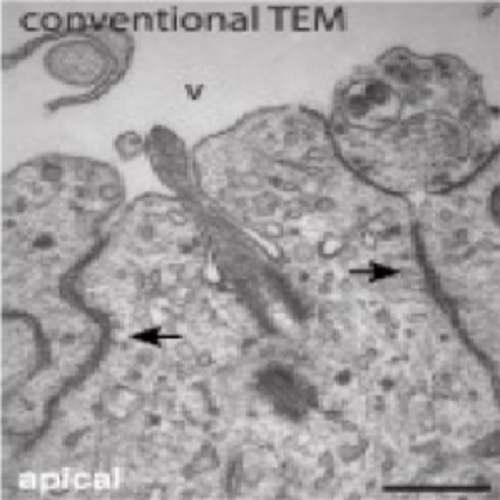 Fig.4 taken from Paridaen et al, 2015.