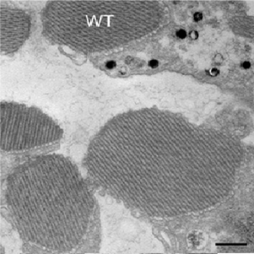 Fig.6 taken from Pocha et al, 2011.