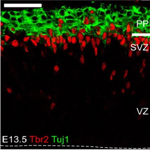 Fig.7 taken from Pulvers et al, 2009.