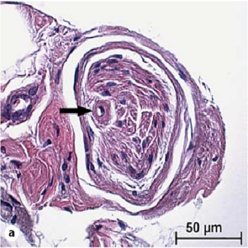 Fig.1 taken from Rein et al, 2013.