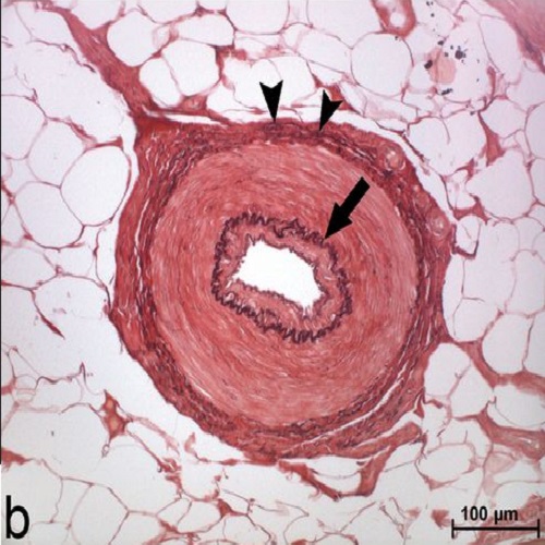 Fig.2 taken from Rein et al, 2013.