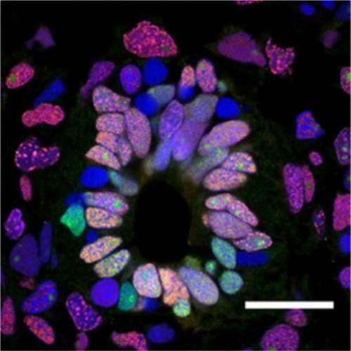 Fig.2 taken from Rodrigo-Albord et al, 2015.